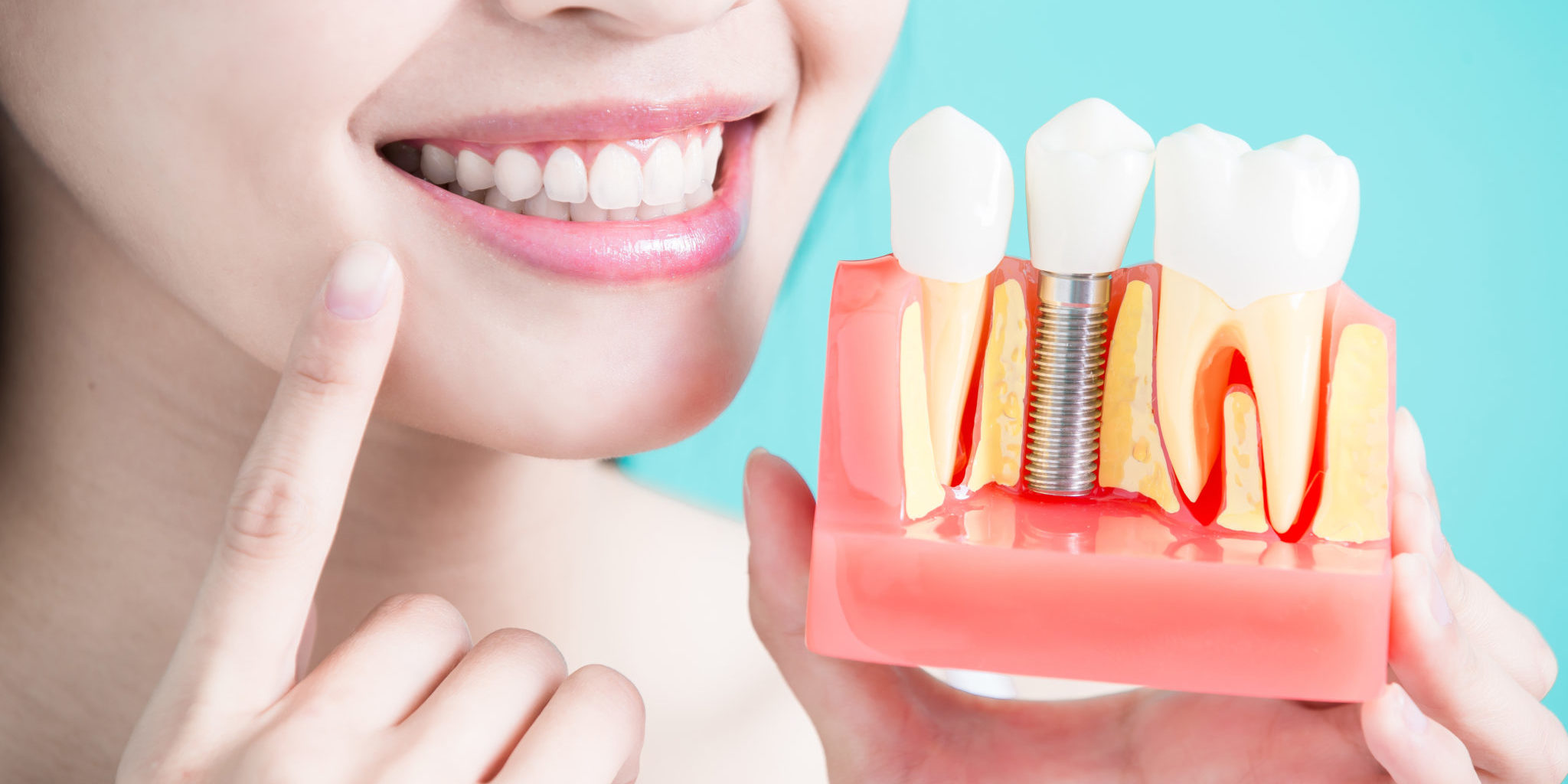 Dental Implants in Birmingham, MI Dr. Thomas Coburn Dr. Michelle Sgalia. Birmingham Dental. General, Cosmetic, Restorative, Preventative, Family Dentistry dentist in Birmingham MI 48009