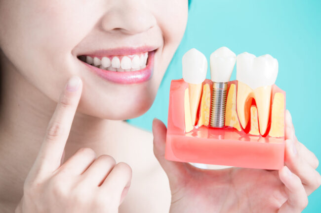 Dental Implants in Birmingham, MI Dr. Thomas Coburn Dr. Michelle Sgalia. Birmingham Dental. General, Cosmetic, Restorative, Preventative, Family Dentistry dentist in Birmingham MI 48009
